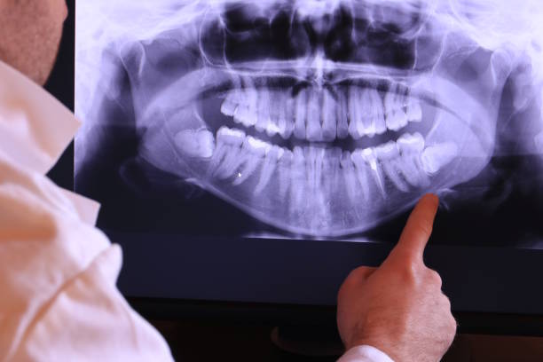 Best Emergency Treatment for Oral Infections in Edinburg, IL